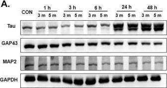 Anti-Tau antibody [TAU-5] - BSA and Azide free (ab80579) | Abcam