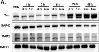 Western blot - Anti-Tau antibody [TAU-5] - BSA and Azide free (AB80579)