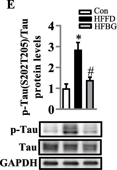 Western blot - Anti-Tau antibody [TAU-5] - BSA and Azide free (AB80579)