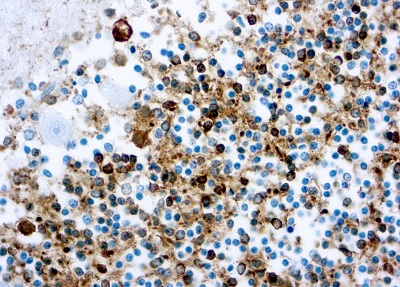 Anti-Tau antibody [Tau46] (ab203179) | Abcam
