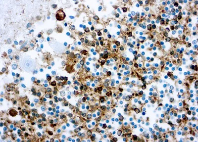 Immunohistochemistry (Formalin/PFA-fixed paraffin-embedded sections) - Anti-Tau antibody [Tau46] (AB203179)