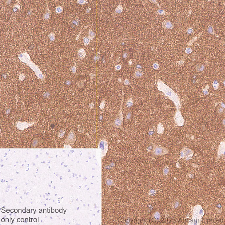 Immunohistochemistry (Formalin/PFA-fixed paraffin-embedded sections) - Anti-Tau - C-terminal (4R-aa396) antibody [EPR29542-63] (AB323709)