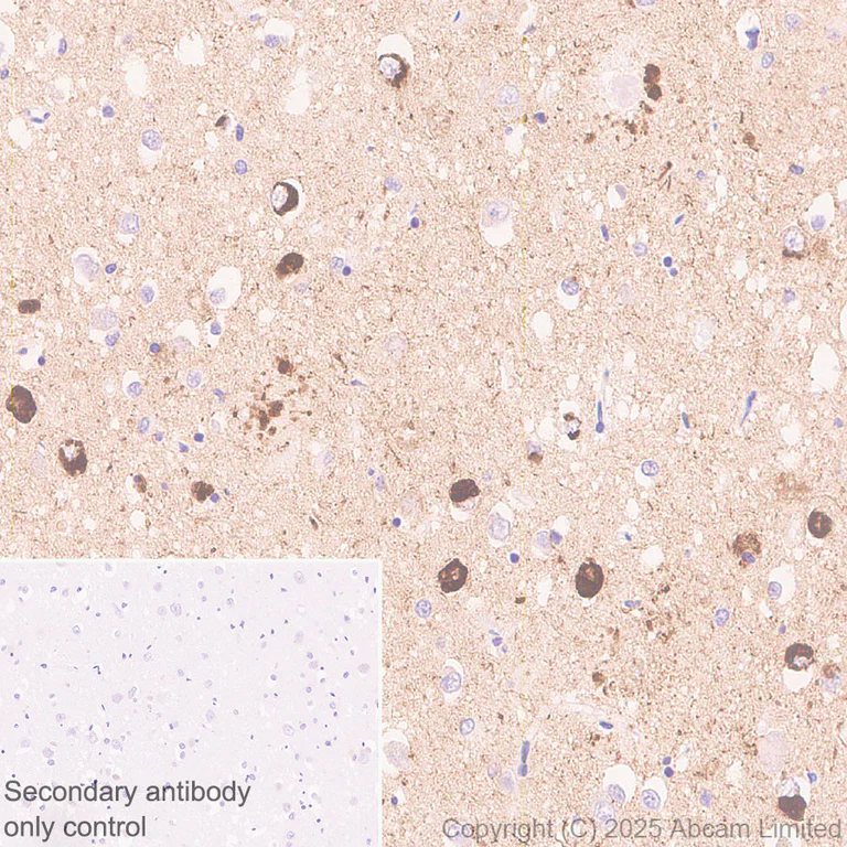 Immunohistochemistry (Formalin/PFA-fixed paraffin-embedded sections) - Anti-Tau - C-terminal (4R-aa396) antibody [EPR29542-63] (AB323709)