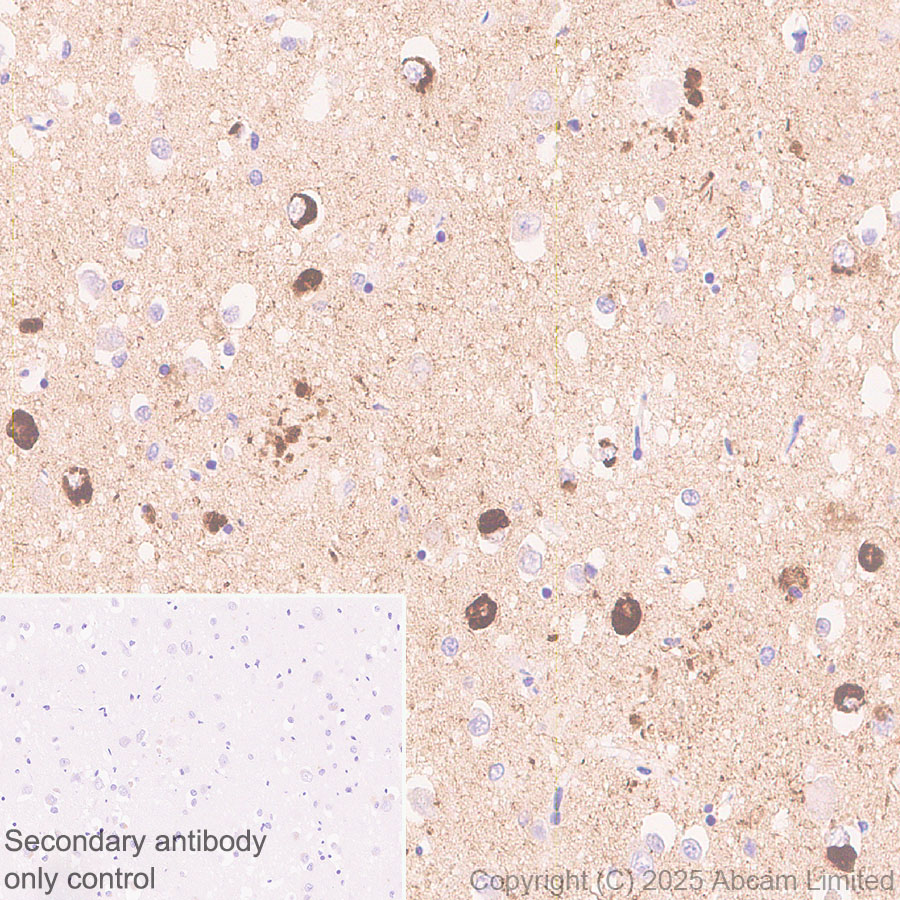Immunohistochemistry (Formalin/PFA-fixed paraffin-embedded sections) - Anti-Tau - C-terminal (4R-aa396) antibody [EPR29542-63] - BSA and Azide free (AB324110), expandable thumbnail