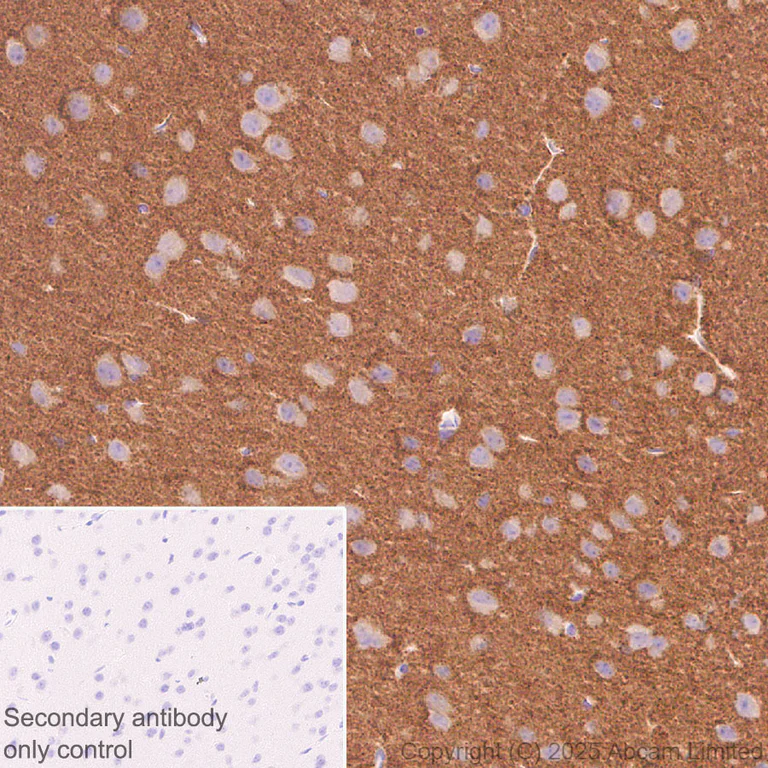 Immunohistochemistry (Formalin/PFA-fixed paraffin-embedded sections) - Anti-Tau - C-terminal (4R-aa396) antibody [EPR29542-63] - BSA and Azide free (AB324110)