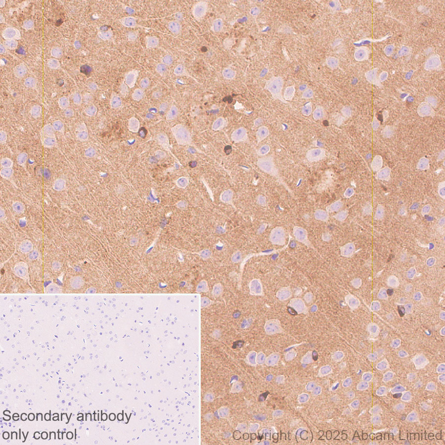 Immunohistochemistry (Formalin/PFA-fixed paraffin-embedded sections) - Anti-Tau - C-terminal (4R-aa396) antibody [EPR29542-63] - BSA and Azide free (ab324110), expandable thumbnail