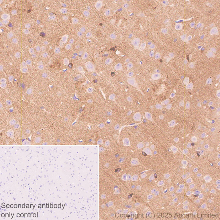 Immunohistochemistry (Formalin/PFA-fixed paraffin-embedded sections) - Anti-Tau - C-terminal (4R-aa396) antibody [EPR29542-63] - BSA and Azide free (AB324110)