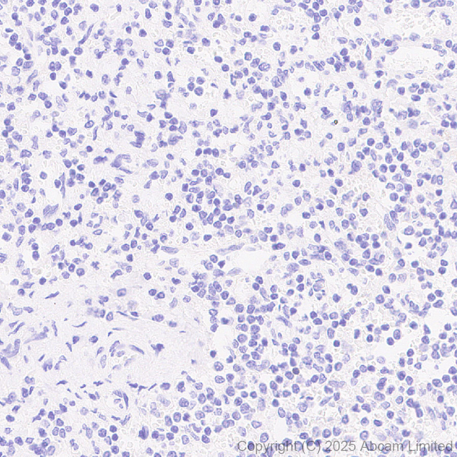 Immunohistochemistry (Formalin/PFA-fixed paraffin-embedded sections) - Anti-Tau - C-terminal (4R-aa396) antibody [EPR29542-63] - BSA and Azide free (ab324110), expandable thumbnail