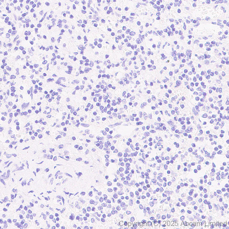 Immunohistochemistry (Formalin/PFA-fixed paraffin-embedded sections) - Anti-Tau - C-terminal (4R-aa396) antibody [EPR29542-63] - BSA and Azide free (AB324110)