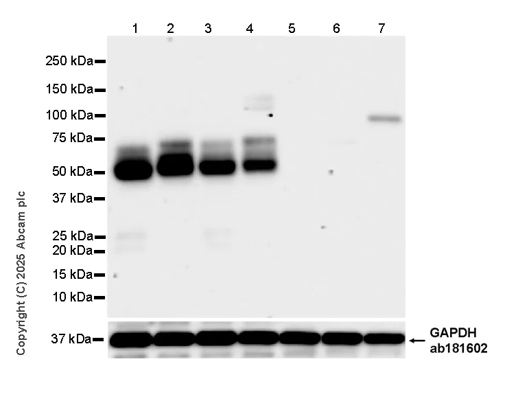 Western blot - Anti-Tau - C-terminal (4R-aa396) antibody [EPR29542-63] - BSA and Azide free (AB324110)