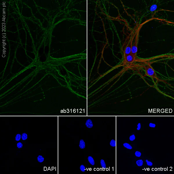 Immunocytochemistry/ Immunofluorescence - Anti-Tau - C-terminal antibody [EPR28785-33] (AB316121)