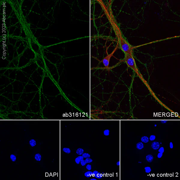 Immunocytochemistry/ Immunofluorescence - Anti-Tau - C-terminal antibody [EPR28785-33] (AB316121)