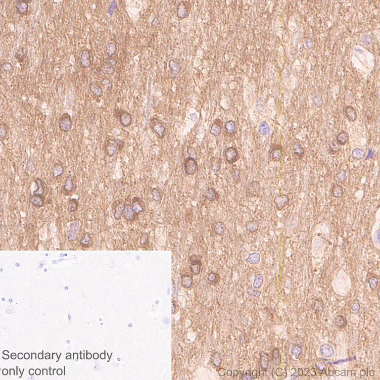 Immunohistochemistry (Formalin/PFA-fixed paraffin-embedded sections) - Anti-Tau - C-terminal antibody [EPR28785-33] - BSA and Azide free (AB316122)