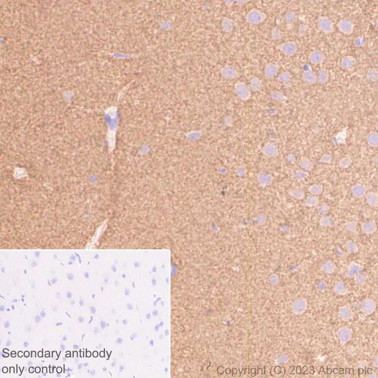 Immunohistochemistry (Formalin/PFA-fixed paraffin-embedded sections) - Anti-Tau antibody [EPR28785-33] - BSA and Azide free (AB316122)