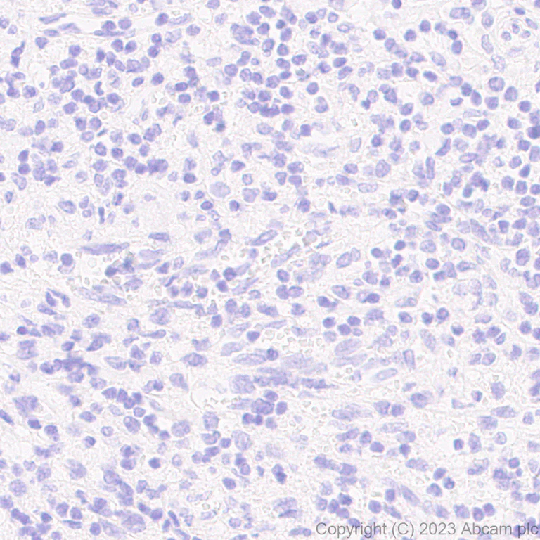 Immunohistochemistry (Formalin/PFA-fixed paraffin-embedded sections) - Anti-Tau - C-terminal antibody [EPR28785-33] - BSA and Azide free (AB316122)