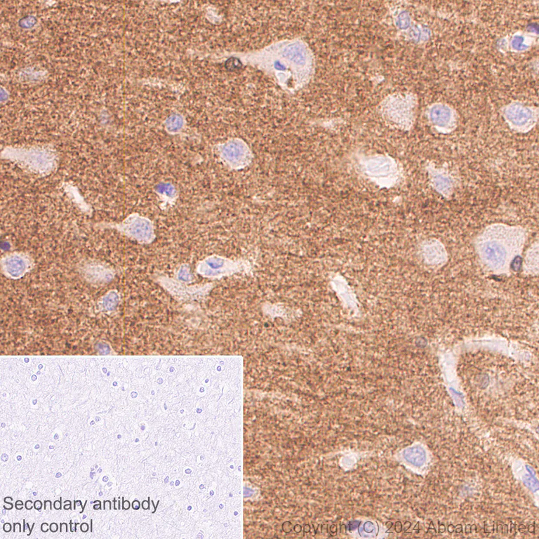 Immunohistochemistry (Formalin/PFA-fixed paraffin-embedded sections) - Anti-Tau - C-terminal antibody [EPR28785-33] - BSA and Azide free (AB316122)