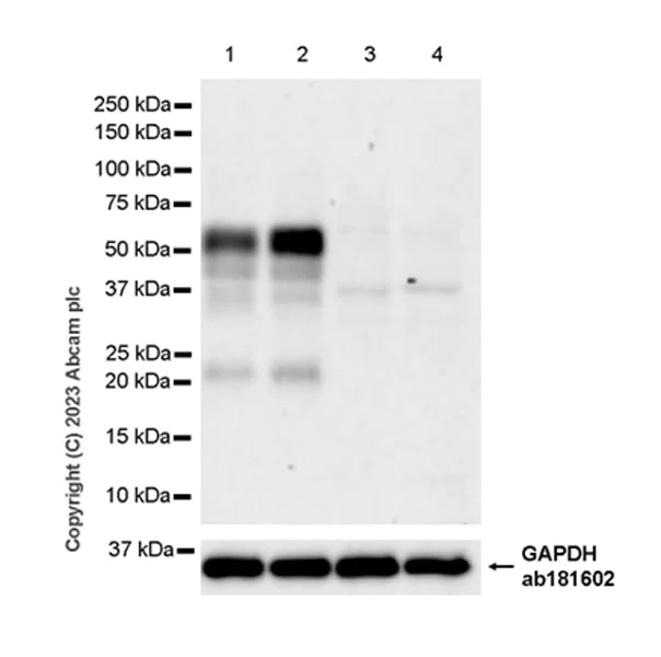 Western blot - Anti-Tau - C-terminal antibody [EPR28785-33] - BSA and Azide free (AB316122)