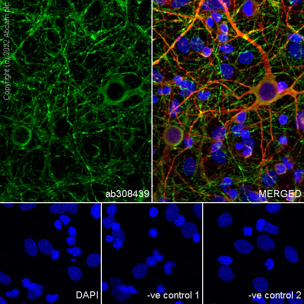 Immunocytochemistry/ Immunofluorescence - Anti-Tau (MBD region) antibody [EPR25205-233] (AB308439)