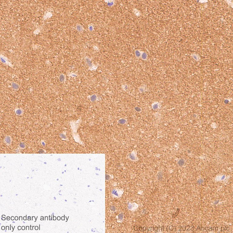 Immunohistochemistry (Formalin/PFA-fixed paraffin-embedded sections) - Anti-Tau (MBD region) antibody [EPR25205-233] (AB308439)