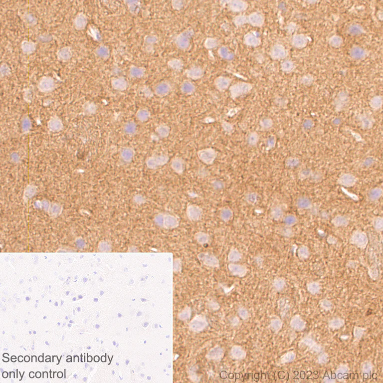 Immunohistochemistry (Formalin/PFA-fixed paraffin-embedded sections) - Anti-Tau (MBD region) antibody [EPR25205-233] (AB308439)