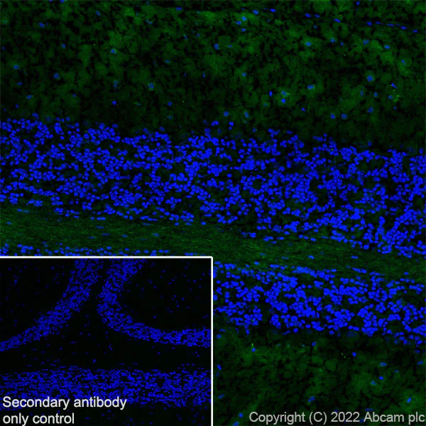 Immunohistochemistry (Frozen sections) - Anti-Tau (MBD region) antibody [EPR25205-233] (AB308439)