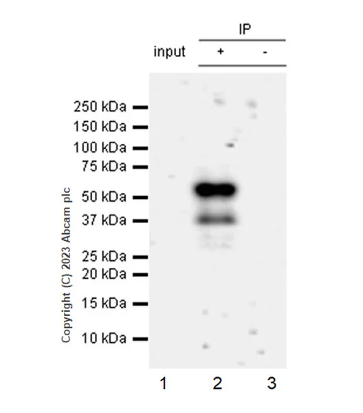 Immunoprecipitation - Anti-Tau (MBD region) antibody [EPR25205-233] (AB308439)
