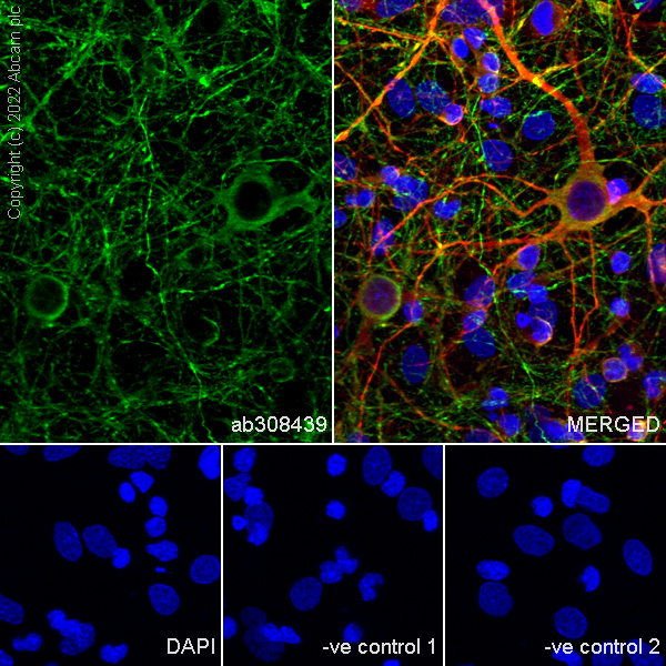 Immunocytochemistry/ Immunofluorescence - Anti-Tau (MBD region) antibody [EPR25205-233] - BSA and Azide free (AB308440), expandable thumbnail