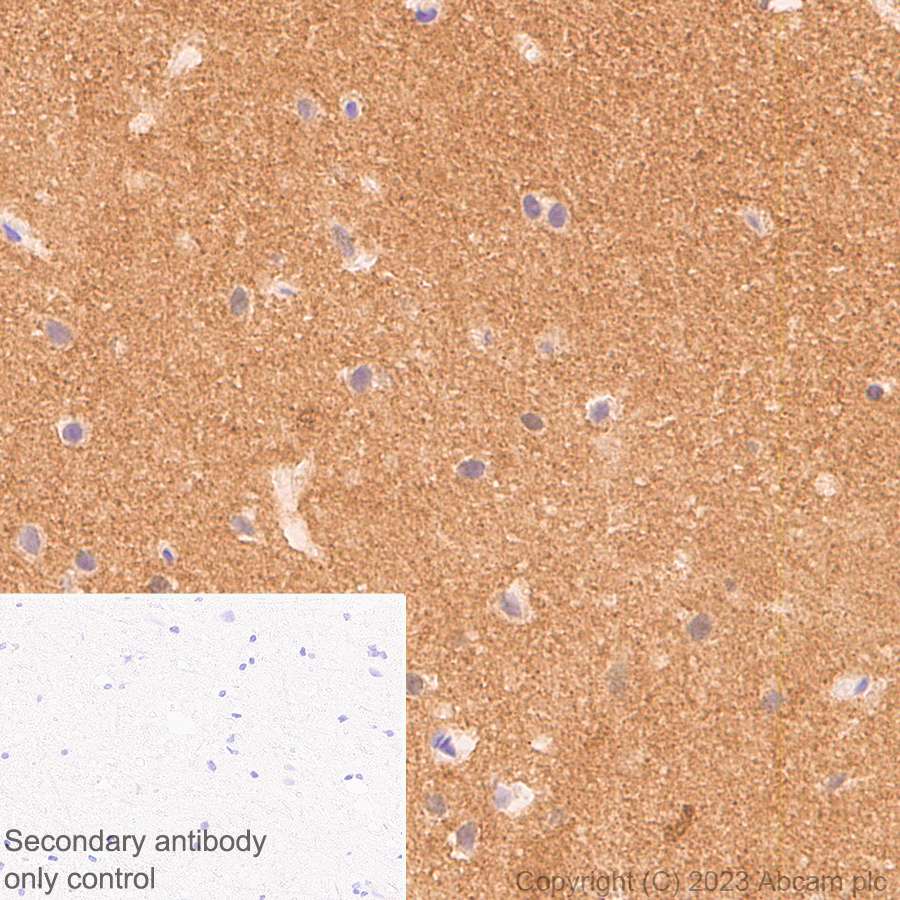 Immunohistochemistry (Formalin/PFA-fixed paraffin-embedded sections) - Anti-Tau (MBD region) antibody [EPR25205-233] - BSA and Azide free (ab308440), expandable thumbnail