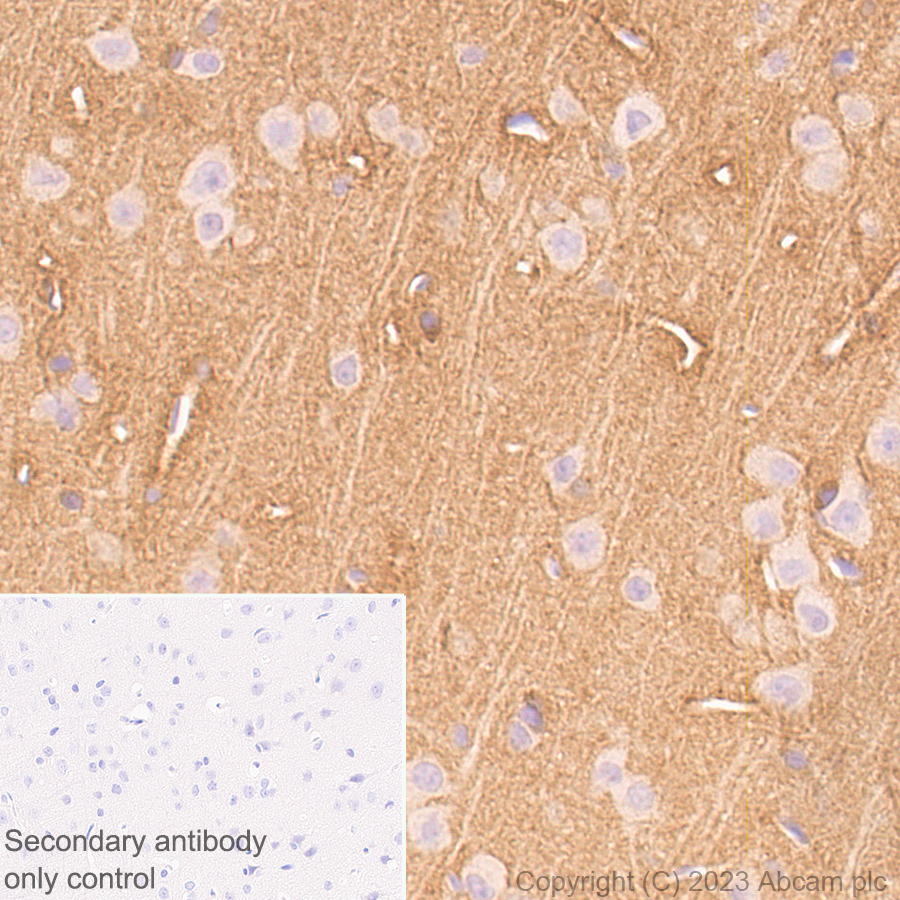 Immunohistochemistry (Formalin/PFA-fixed paraffin-embedded sections) - Anti-Tau (MBD region) antibody [EPR25205-233] - BSA and Azide free (ab308440), expandable thumbnail