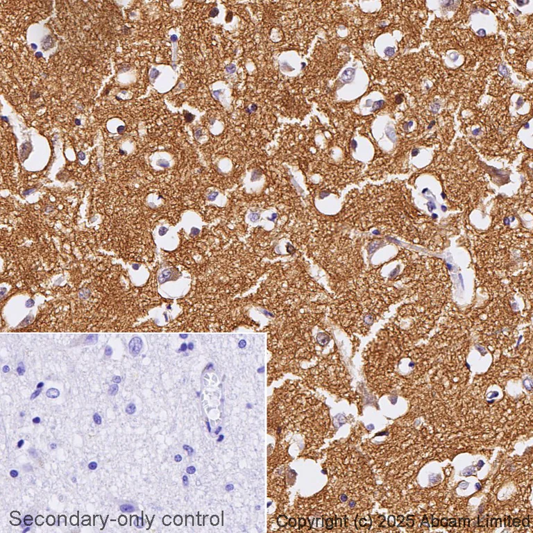 Immunohistochemistry (Formalin/PFA-fixed paraffin-embedded sections) - Anti-Tau (MBD region) antibody [EPR25205-233] - BSA and Azide free (AB308440)