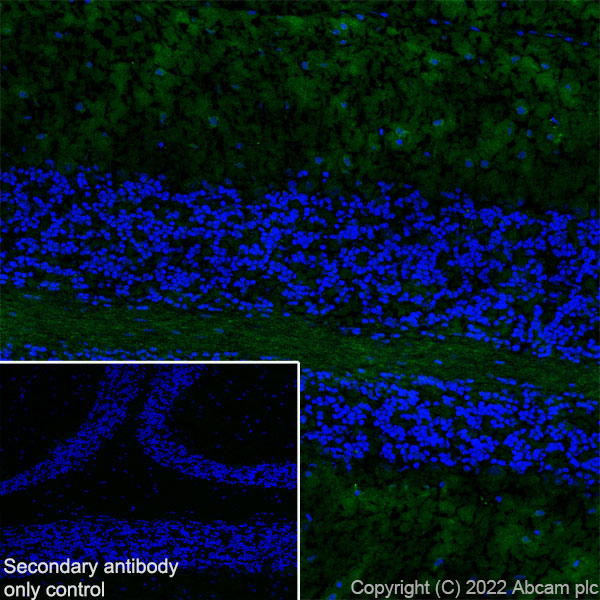 Immunohistochemistry (Frozen sections) - Anti-Tau (MBD region) antibody [EPR25205-233] - BSA and Azide free (AB308440), expandable thumbnail