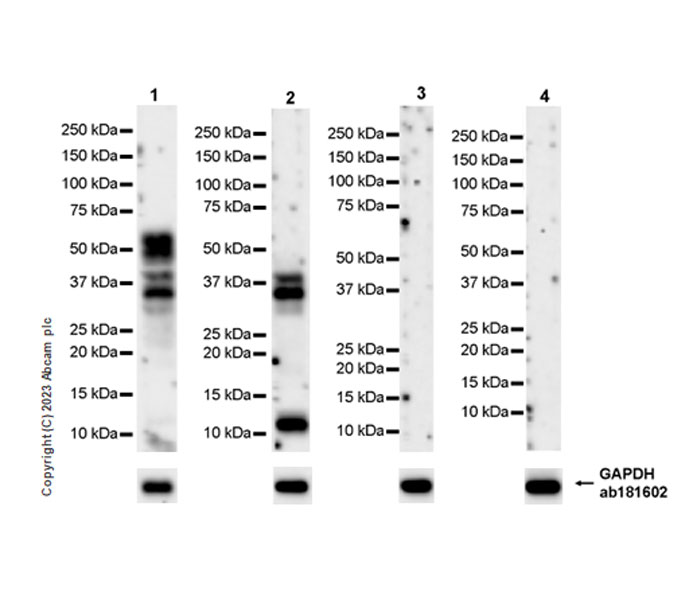 Western blot - Anti-Tau (MBD region) antibody [EPR25205-233] - BSA and Azide free (ab308440), expandable thumbnail