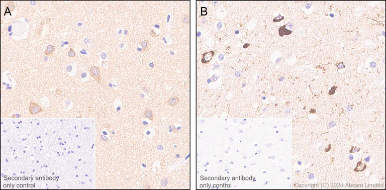 Immunohistochemistry (Formalin/PFA-fixed paraffin-embedded sections) - Anti-Tau (MTBR-tau243) antibody [EPR29541-59] (AB322554)