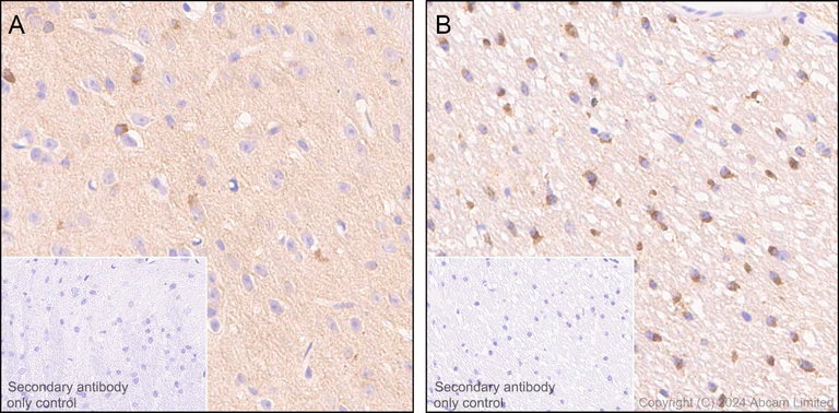 Immunohistochemistry (Formalin/PFA-fixed paraffin-embedded sections) - Anti-Tau (MTBR-tau243) antibody [EPR29541-59] (AB322554)