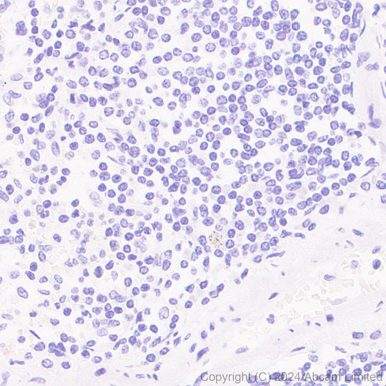 Immunohistochemistry (Formalin/PFA-fixed paraffin-embedded sections) - Anti-Tau (MTBR-tau243) antibody [EPR29541-59] (AB322554)