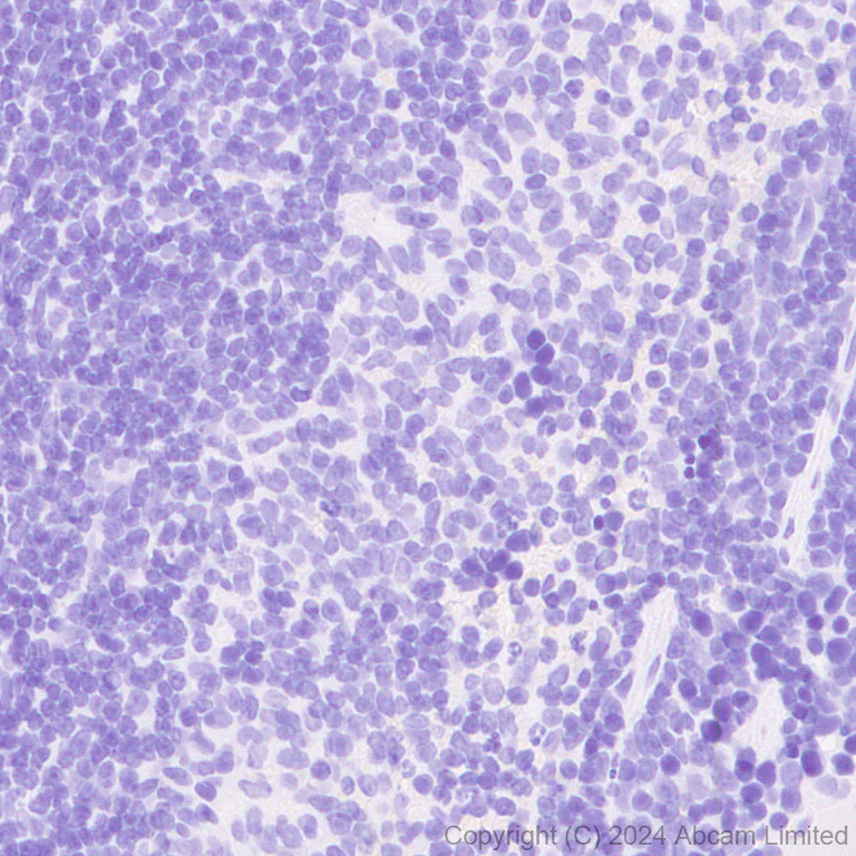 Immunohistochemistry (Formalin/PFA-fixed paraffin-embedded sections) - Anti-Tau (MTBR-tau243) antibody [EPR29541-59] (AB322554)