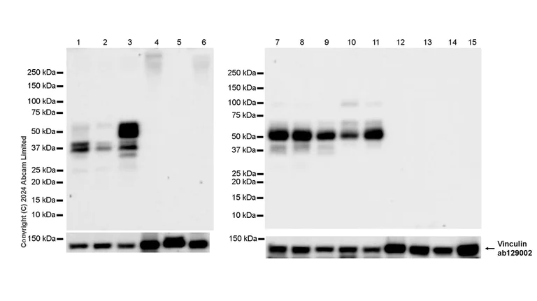 Western blot - Anti-Tau (MTBR-tau243) antibody [EPR29541-59] (AB322554)