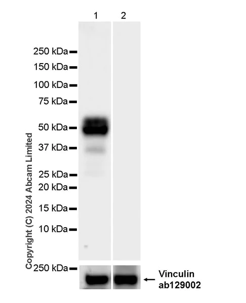 Western blot - Anti-Tau (MTBR-tau243) antibody [EPR29541-59] (AB322554)