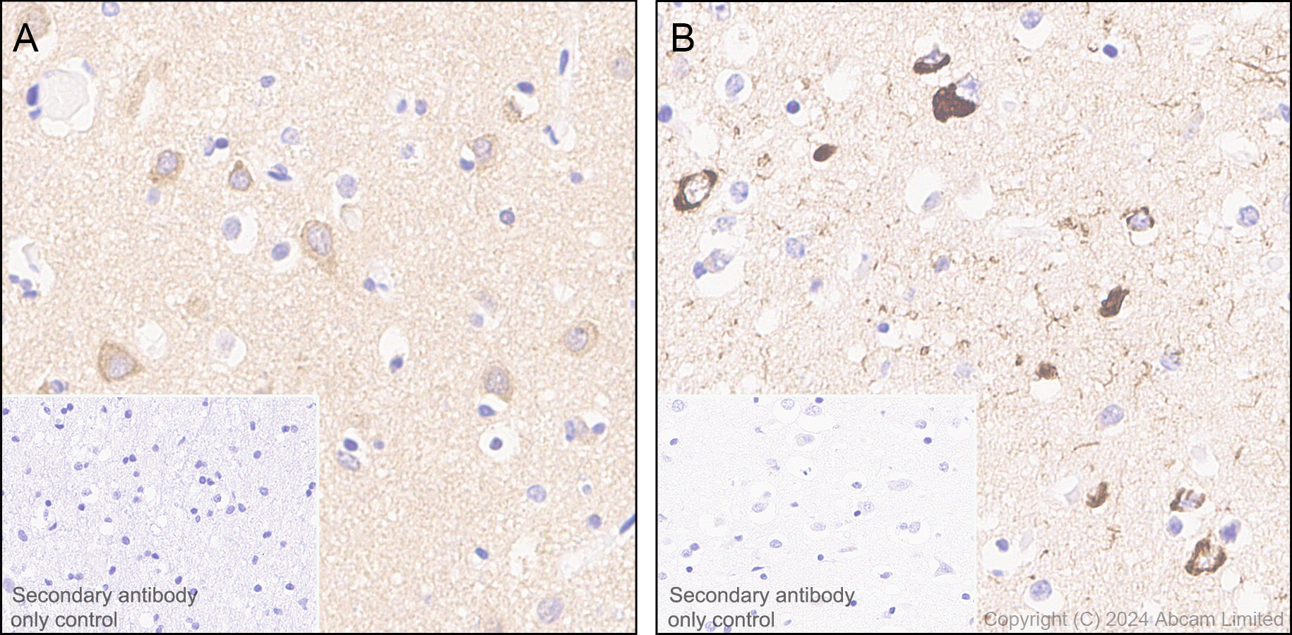 Immunohistochemistry (Formalin/PFA-fixed paraffin-embedded sections) - Anti-Tau (MTBR-tau243) antibody [EPR29541-59]  - BSA and Azide free (ab323528), expandable thumbnail