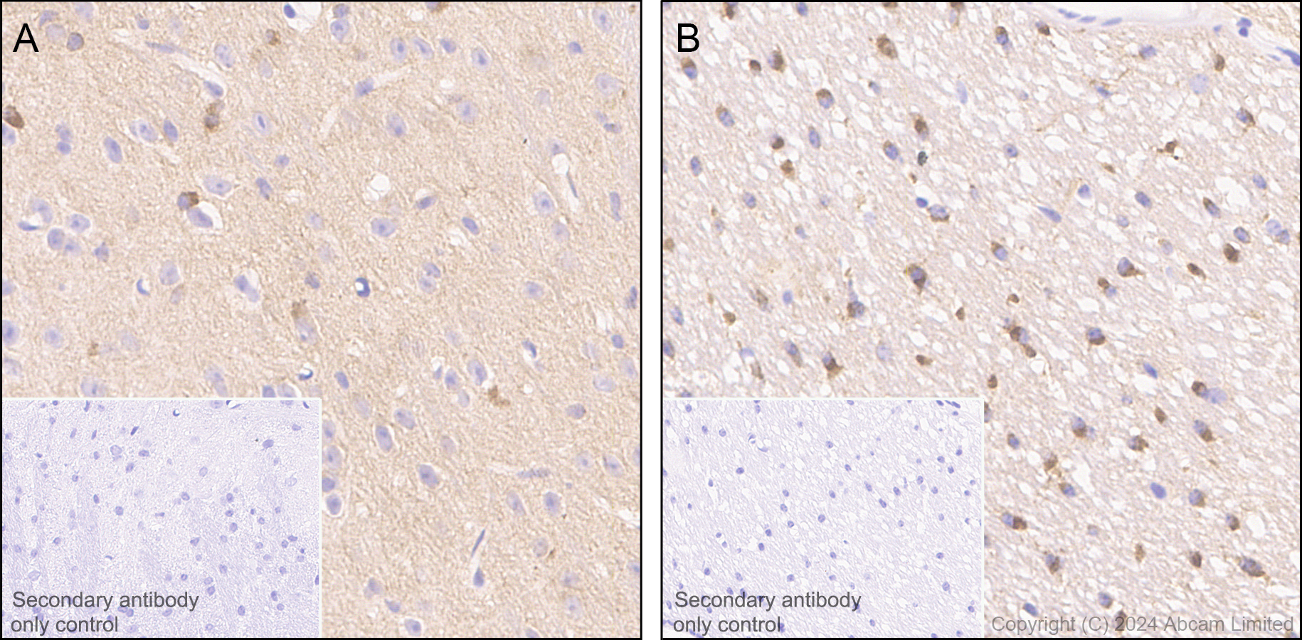 Immunohistochemistry (Formalin/PFA-fixed paraffin-embedded sections) - Anti-Tau (MTBR-tau243) antibody [EPR29541-59]  - BSA and Azide free (ab323528), expandable thumbnail