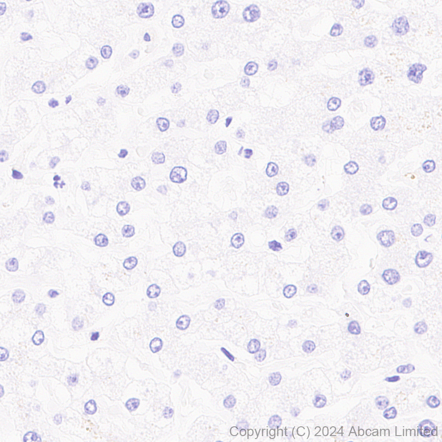 Immunohistochemistry (Formalin/PFA-fixed paraffin-embedded sections) - Anti-Tau (MTBR-tau243) antibody [EPR29541-59]  - BSA and Azide free (ab323528), expandable thumbnail