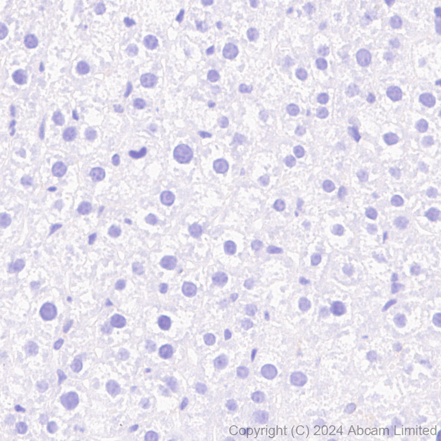 Immunohistochemistry (Formalin/PFA-fixed paraffin-embedded sections) - Anti-Tau (MTBR-tau243) antibody [EPR29541-59]  - BSA and Azide free (AB323528), expandable thumbnail