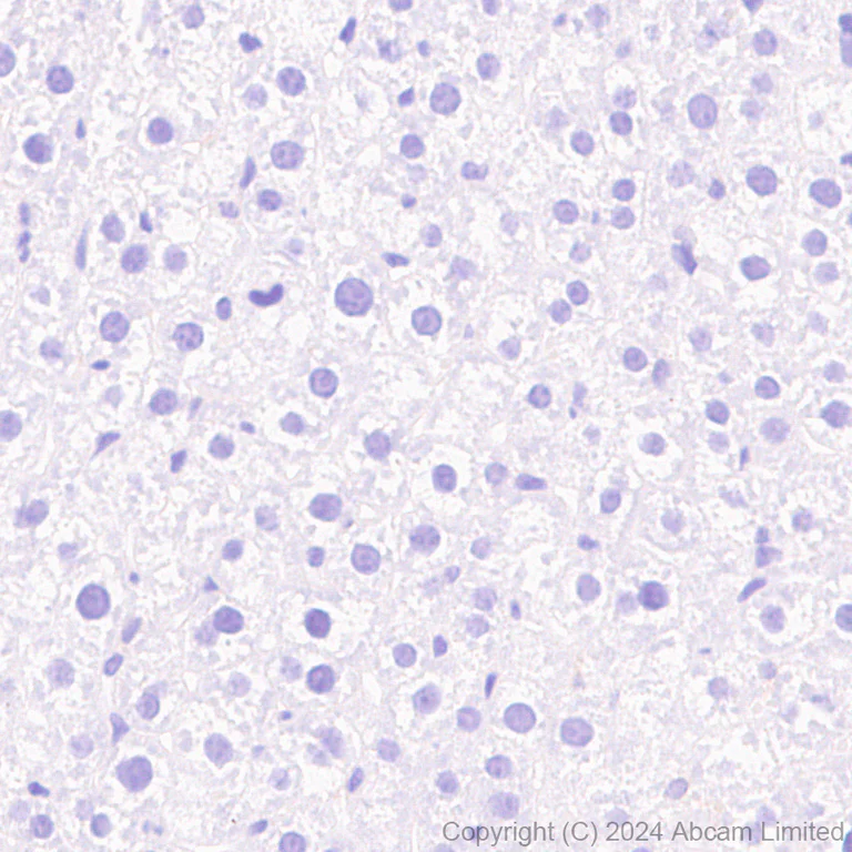 Immunohistochemistry (Formalin/PFA-fixed paraffin-embedded sections) - Anti-Tau (MTBR-tau243) antibody [EPR29541-59] - BSA and Azide free (AB323528)