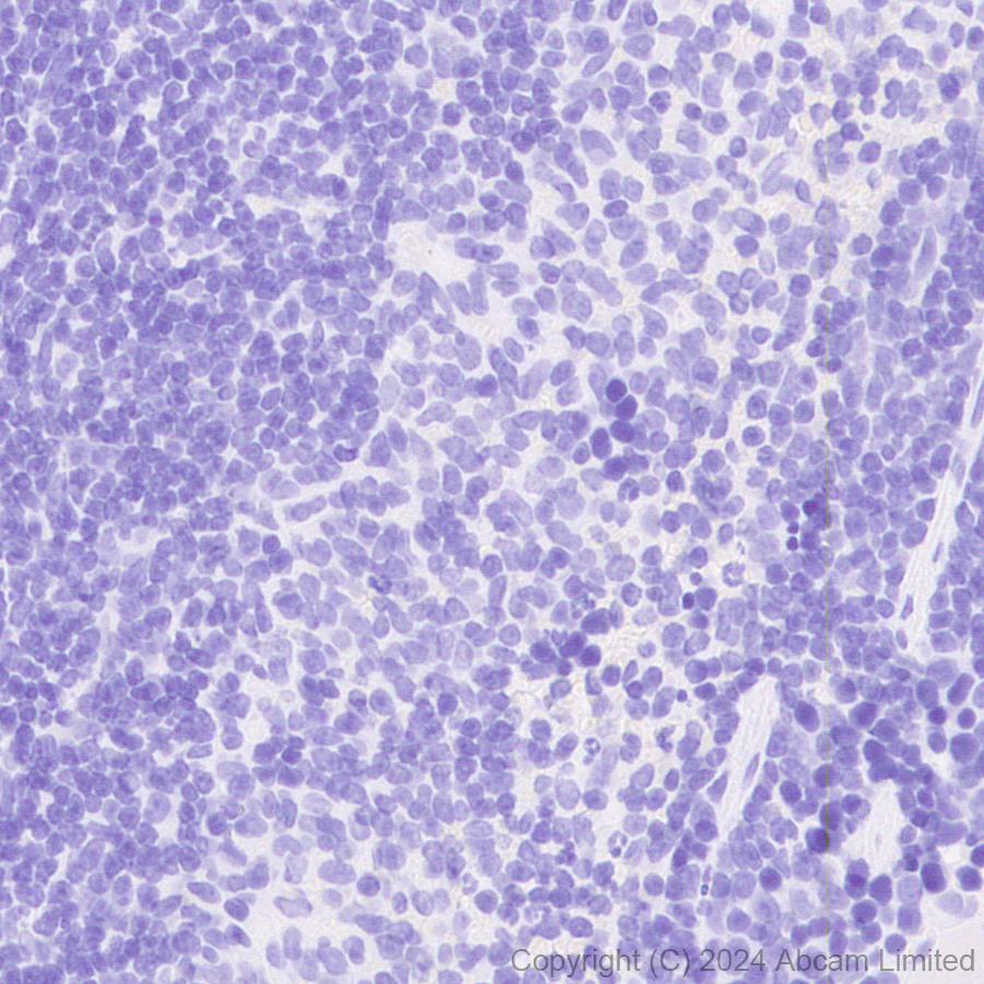 Immunohistochemistry (Formalin/PFA-fixed paraffin-embedded sections) - Anti-Tau (MTBR-tau243) antibody [EPR29541-59]  - BSA and Azide free (AB323528), expandable thumbnail