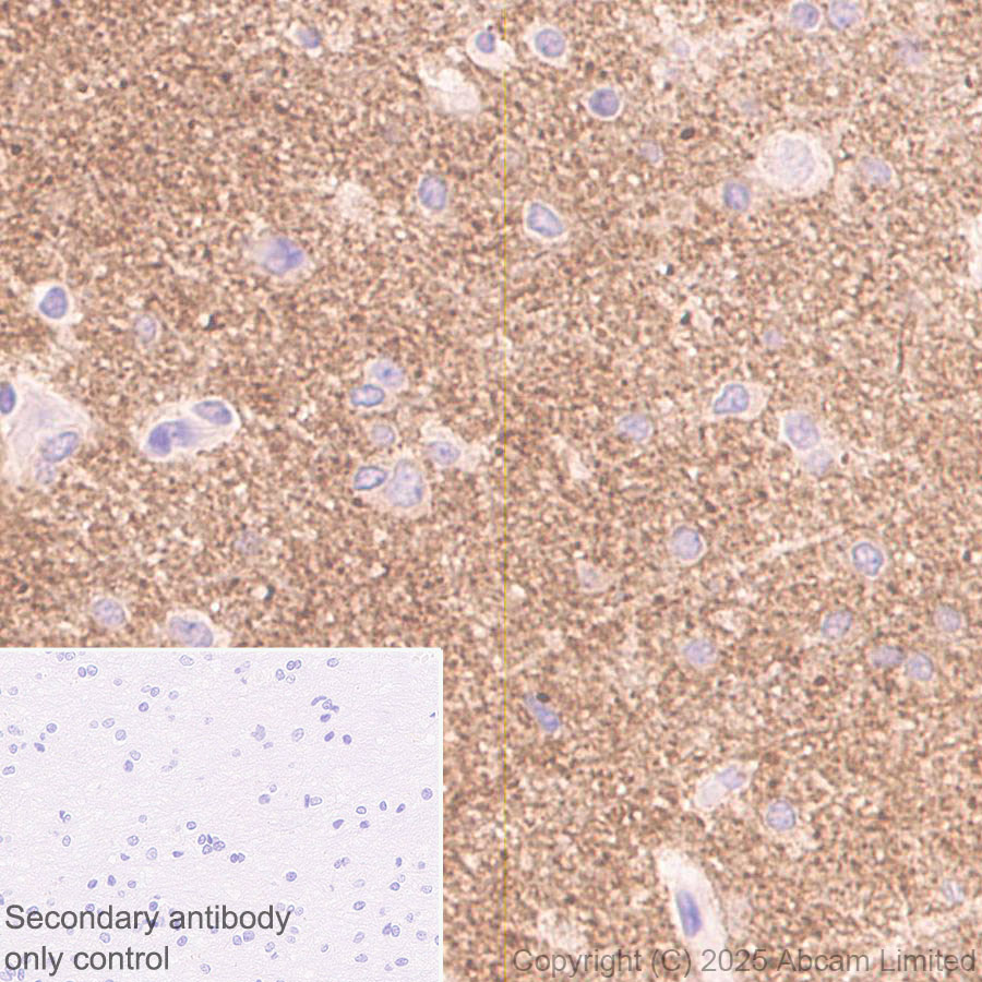 Immunohistochemistry (Formalin/PFA-fixed paraffin-embedded sections) - Anti-Tau (N-terminal) antibody [EPR29521-8] (ab324236), expandable thumbnail