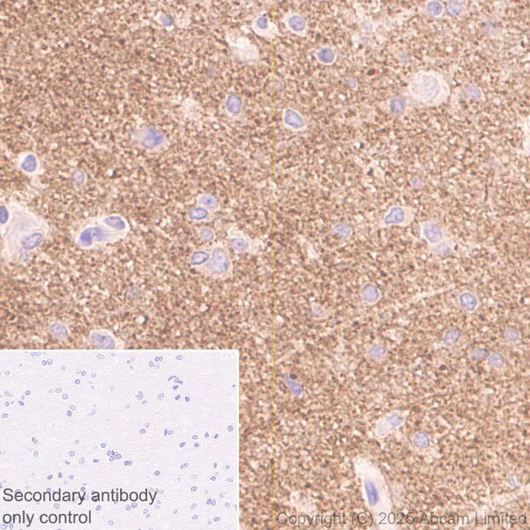 Immunohistochemistry (Formalin/PFA-fixed paraffin-embedded sections) - Anti-Tau (N-terminal) antibody [EPR29521-8] (AB324236)