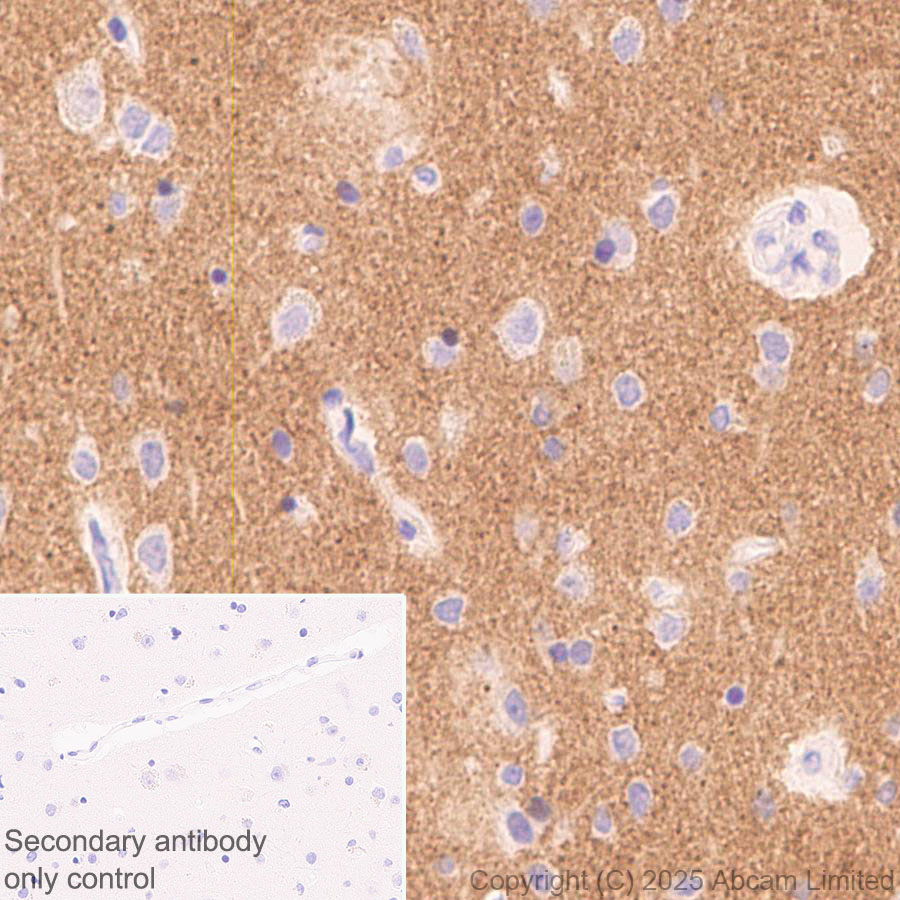 Immunohistochemistry (Formalin/PFA-fixed paraffin-embedded sections) - Anti-Tau (N-terminal) antibody [EPR29521-8] (ab324236), expandable thumbnail