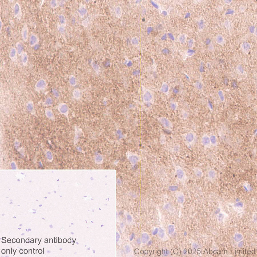 Immunohistochemistry (Formalin/PFA-fixed paraffin-embedded sections) - Anti-Tau (N-terminal) antibody [EPR29521-8] (AB324236), expandable thumbnail