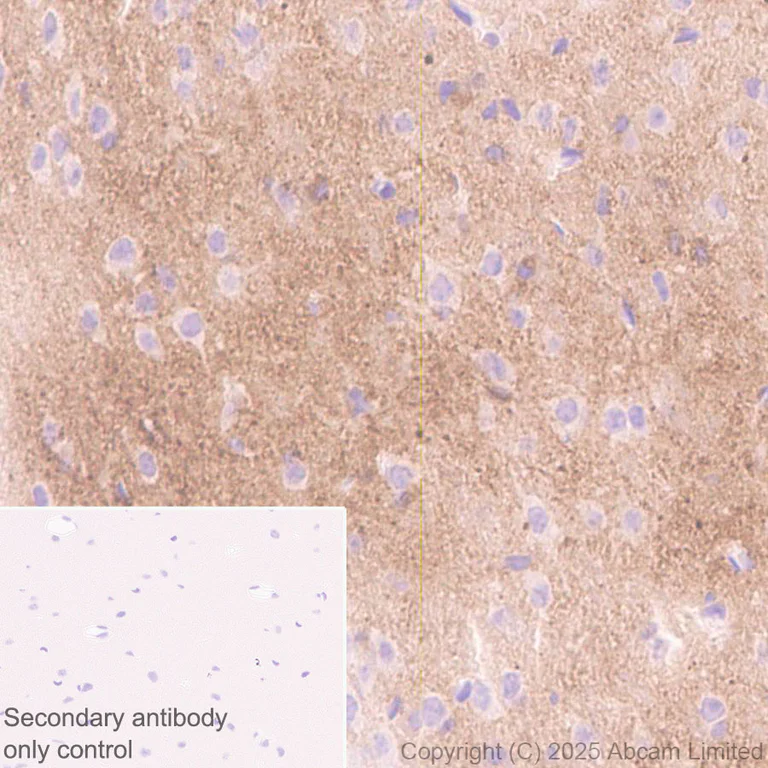 Immunohistochemistry (Formalin/PFA-fixed paraffin-embedded sections) - Anti-Tau (N-terminal) antibody [EPR29521-8] (AB324236)