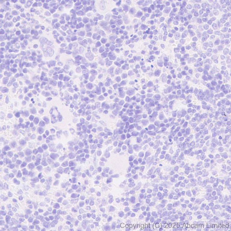 Immunohistochemistry (Formalin/PFA-fixed paraffin-embedded sections) - Anti-Tau (N-terminal) antibody [EPR29521-8] (AB324236)
